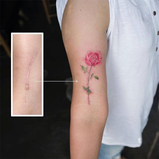 scars-tattoo-cover-up-37-590b1ddb1a2d9__605.jpg