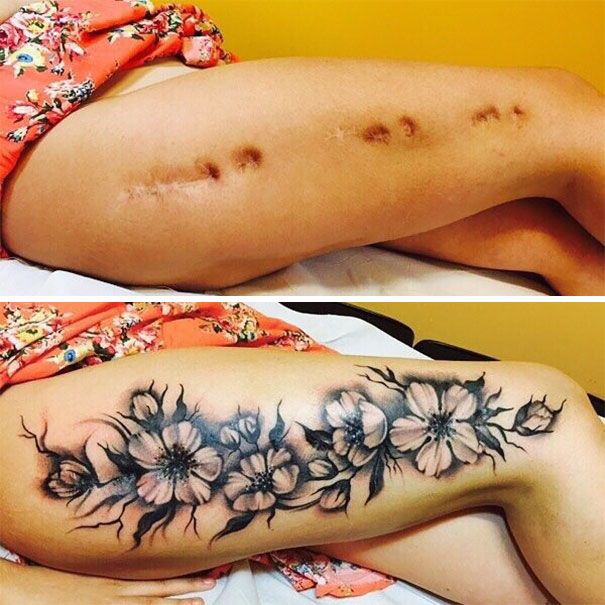 scars-tattoo-cover-up-46-590b24604a6a5__605.jpg