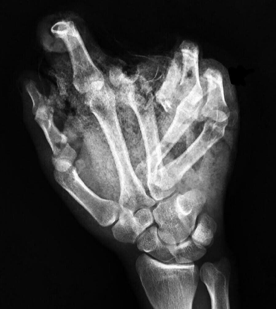 injury5-176749203.jpeg